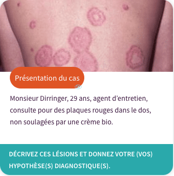lesions-dos