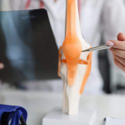 Doctor traumatologist examines x-ray and legs and the model of knee joint. Injuries and sprains concept