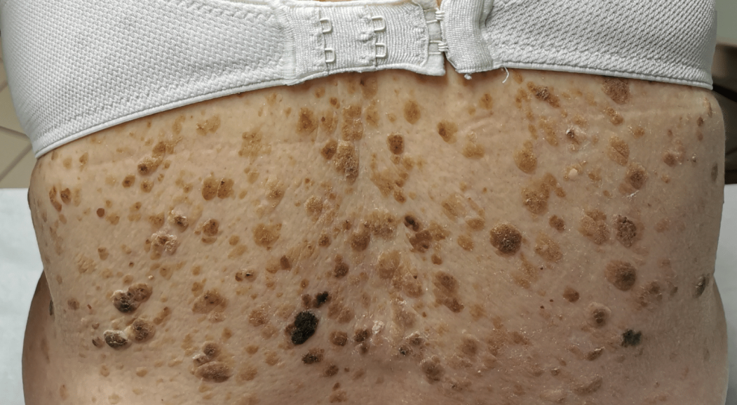 dermatologie dos pathologie