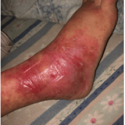 pathologie dermatologie